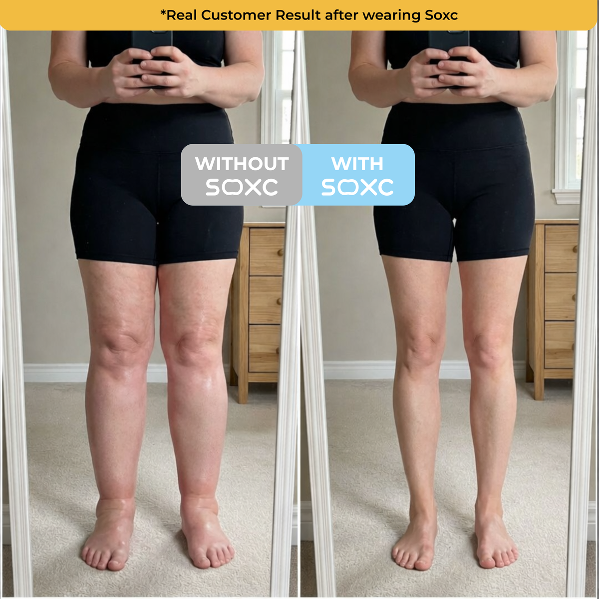 The Swell Relief Sock for Edema Relief
