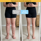 The Swell Relief Sock for Edema Relief