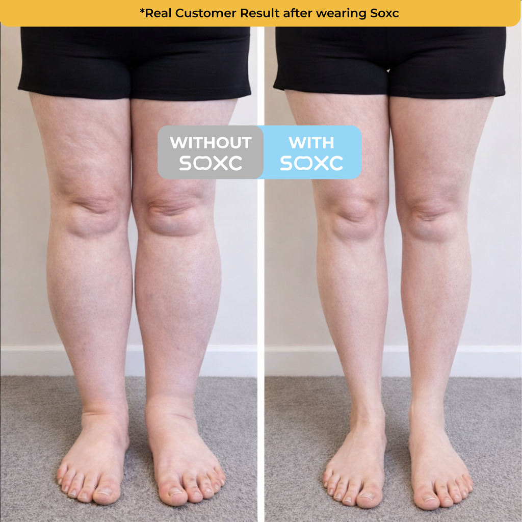 The Swell Relief Sock for Edema Relief
