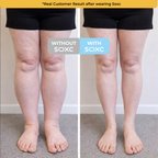 The Swell Relief Sock for Edema Relief