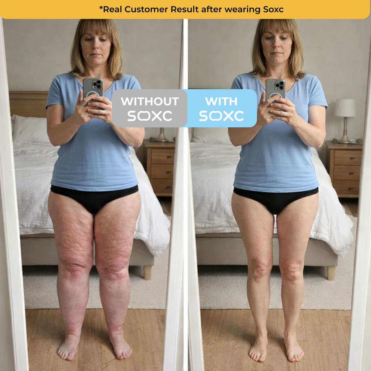 The Swell Relief Sock for Edema Relief
